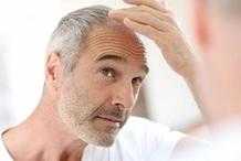 白頭髮不能輕易拔？哈佛研究：長白髮的人，不易患癌？靠譜嗎？