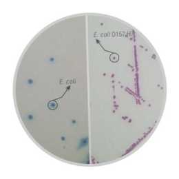 顯色培養基在臨床微生物學上的應用（下）