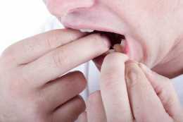 口腔扁平苔蘚的治療和護理需要注意什麼？