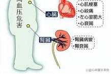 中國高血壓診斷標準從14090降到13080，新高血壓人要不要吃藥？