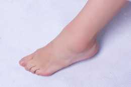 扁平足與正常腳部有什麼區別？扁平足有哪些影響？