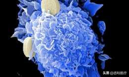 《致癌作用》對付產生化療耐藥的癌細胞，穿心蓮可助一臂之力